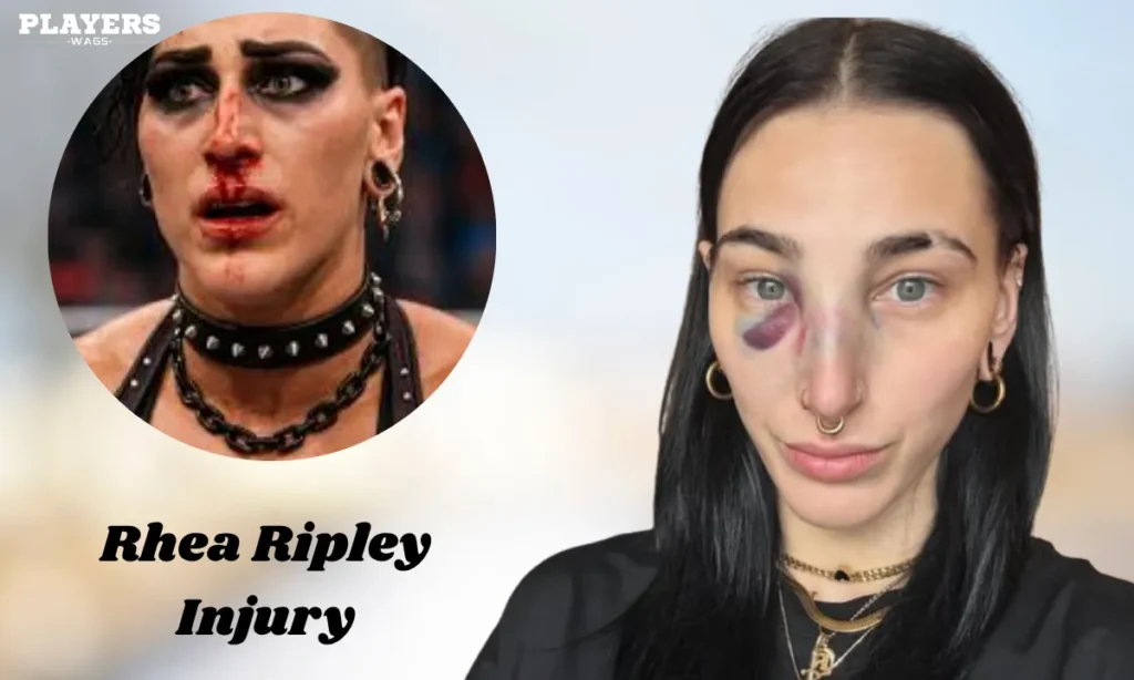 Rhea Ripley Injury 